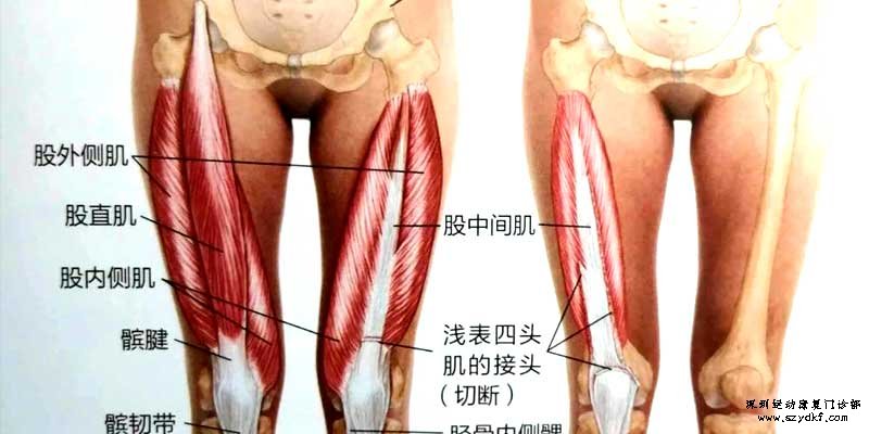 股四头肌|膝关节的“守护神”