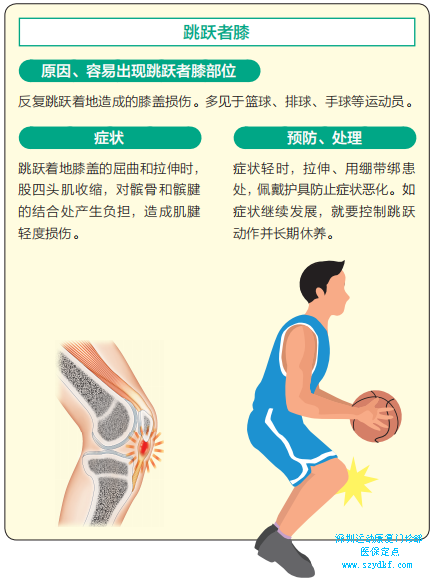 下面就对运动中常见的肌肉与肌腱损伤简单说明5