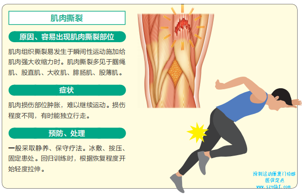 下面就对运动中常见的肌肉与肌腱损伤简单说明6