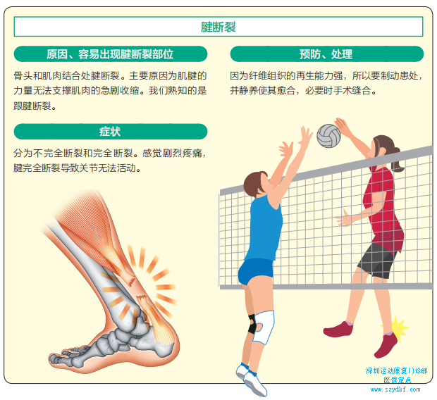 下面就对运动中常见的肌肉与肌腱损伤简单说明7