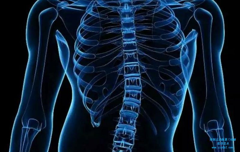 腰骶关节炎脊柱侧弯