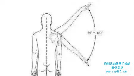 患肩外展未到60度时疼痛较轻，被动外展至60-120度范围时，疼痛较重
