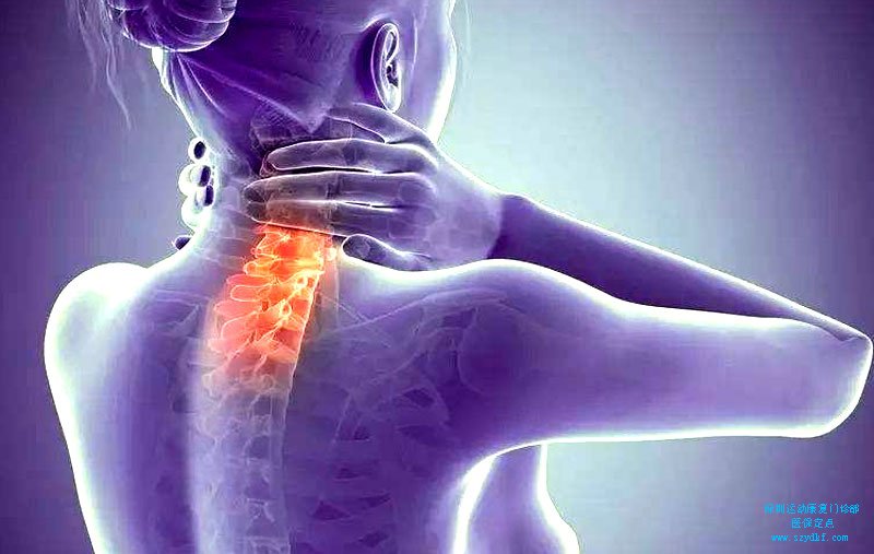 颈肩疼痛5年-劲椎病