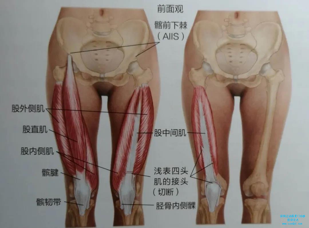 股四头肌在大腿前侧，覆盖住大腿的3/4，是人体少数体积、质量、强力的肌肉。它分为股直肌、股外侧肌、股中间肌和股内侧肌，并通过同一肌腱附着在髌骨上，往下接髌韧带止于胫骨粗隆。四块肌肉组成的膝关节“专业”行动小分队，负责整个膝关节伸展以及稳定。