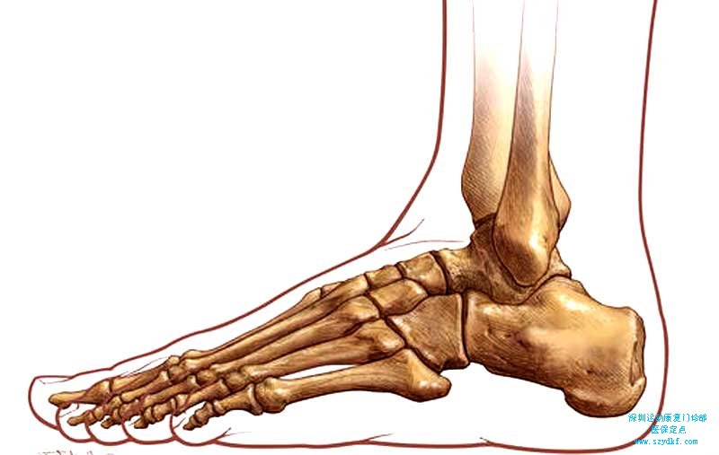 右踝疼痛-踝关节创伤性关节炎