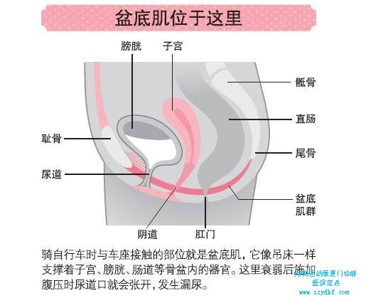 盆底肌训练。