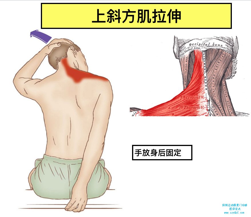 提肩胛肌拉伸