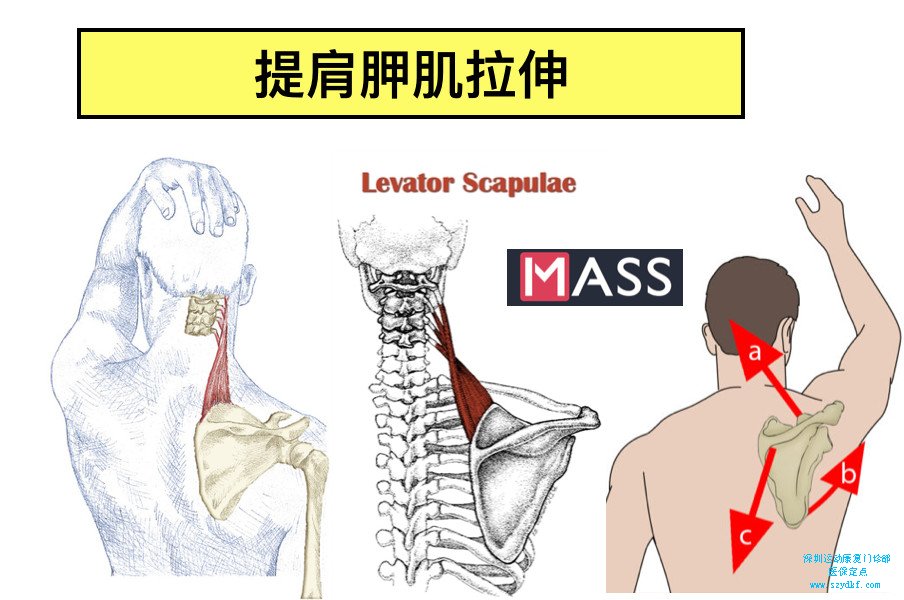 提肩胛肌的起点位于肩胛骨