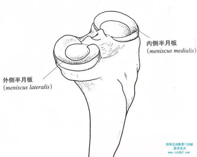 半月板损伤