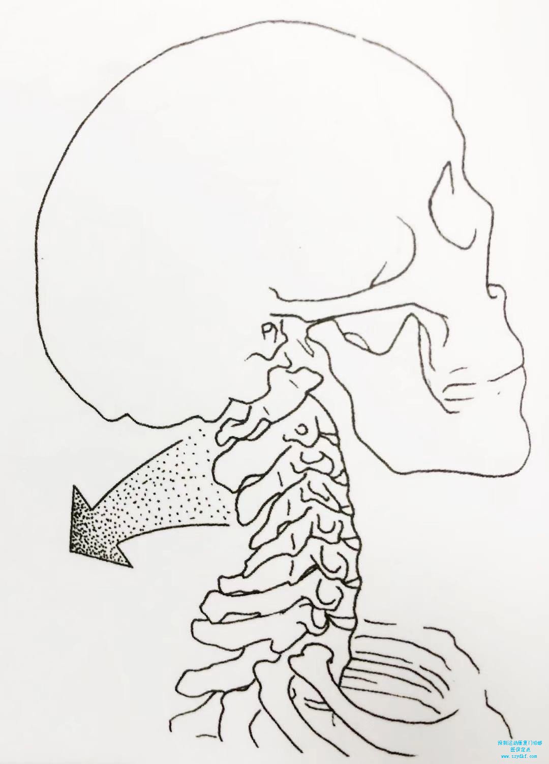 颈椎的正常生理曲度是微微前凸的