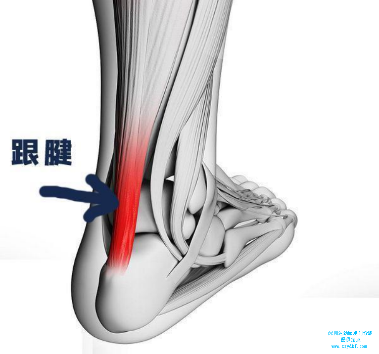 跟腱是小腿后方最粗大的肌腱